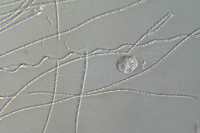 Vorticella e cianobatteri